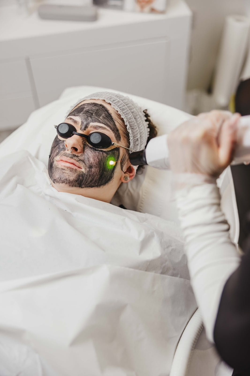 Carbon laser facial