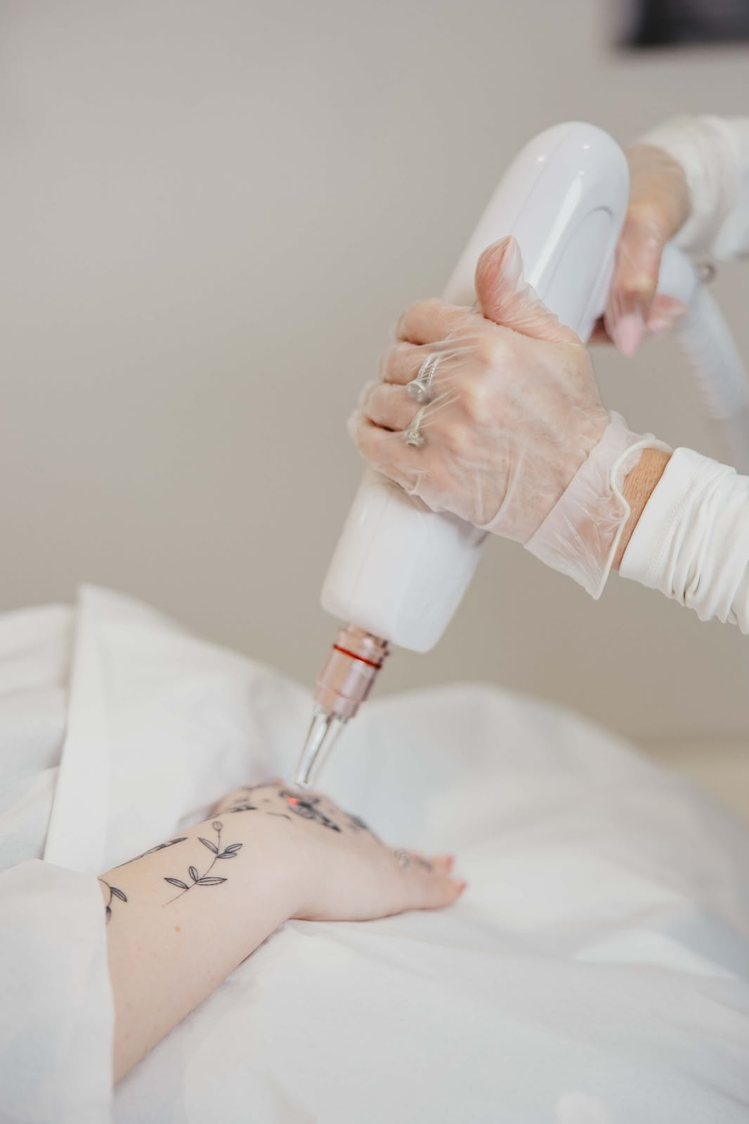 A laser treatment in progress